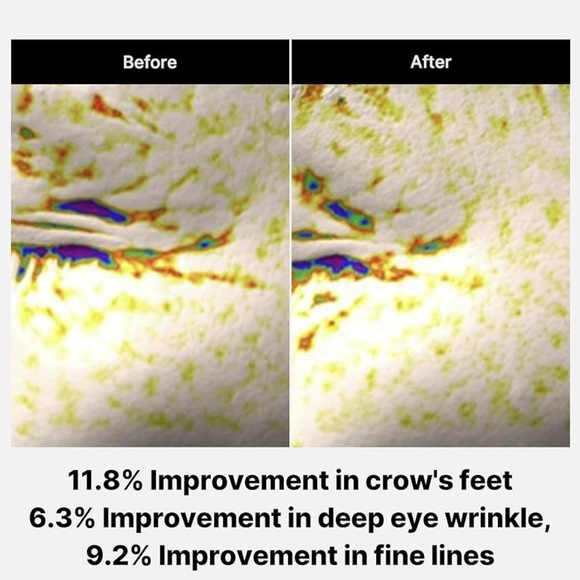 NIB-Medicube Lifting Peptide Deep Lifting Eye Cream - Salmon Sperm Technology - Picture 5 of 5